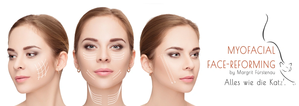 Myofacial Face-Reforming by Margrit Fürstenau